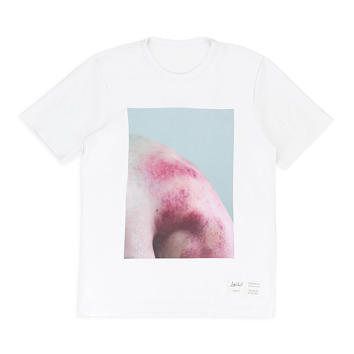 BRUISES WHITE T-SHIRT